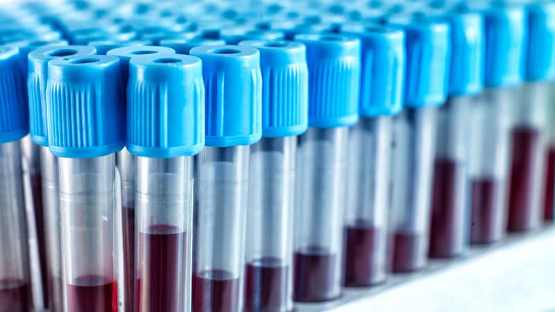 Lab Testing in Patients on Immunomodulators Falls Short