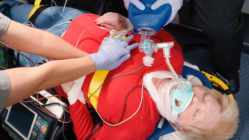 Cardiac Arrest Mortality in US Emergency Departments