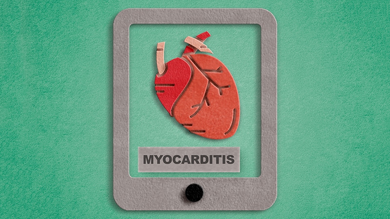 New Myocarditis Staging and Care Pathway: ACC’s Expert Consensus for Diagnosis and Treatment