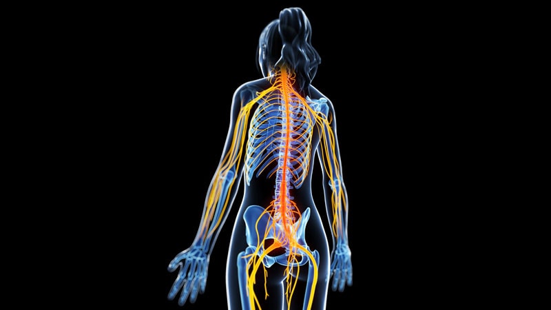 Fibromyalgia Pain Might Start in the Spinal Cord