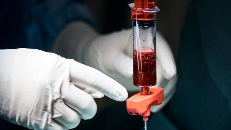 Could Bone Marrow Help Prevent Post-ACL Revision Arthritis?