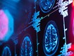 photo of brain scan