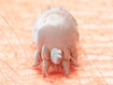 photo of scabies mite