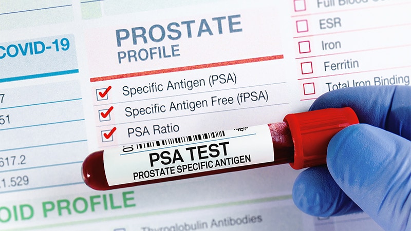 Un nouveau protocole de dépistage pourrait améliorer la détection du cancer de la prostate
