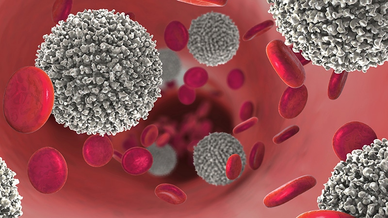 Europe Recommends Stem Cell Therapy for Blood Cancers