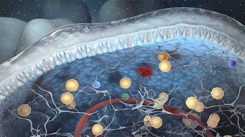 Does Cardio-Protection Work After Anthracycline Chemotherapy?