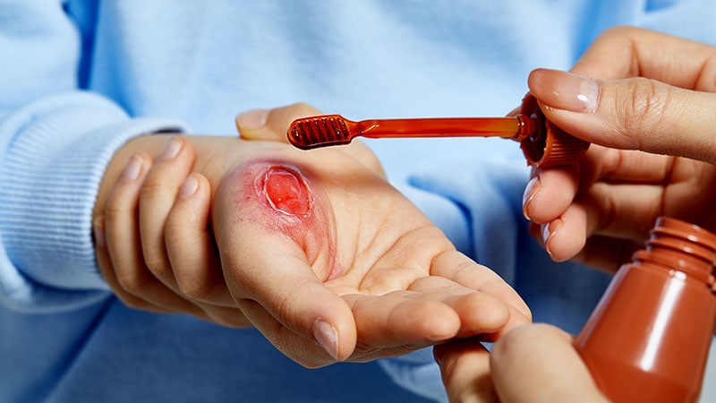 Wound Healing Toolbox Requires Frequent Updating