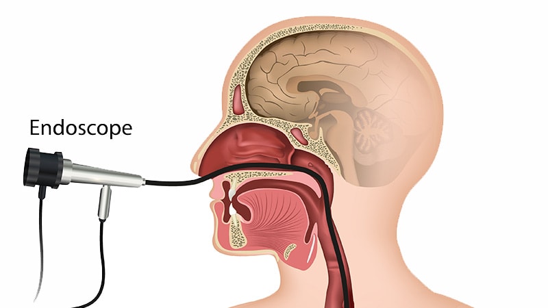 Train Advanced Practice Providers in Transnasal Endoscopy?