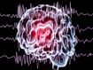 photo of brain waves