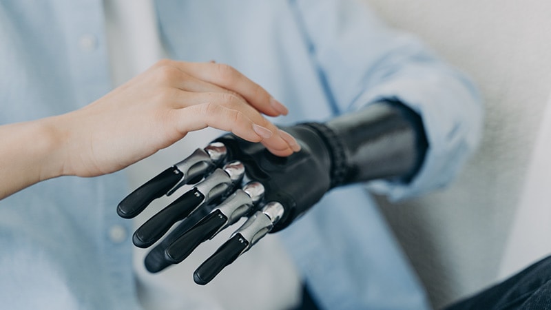 NHS To Offer Bionic Arms to All Amputees