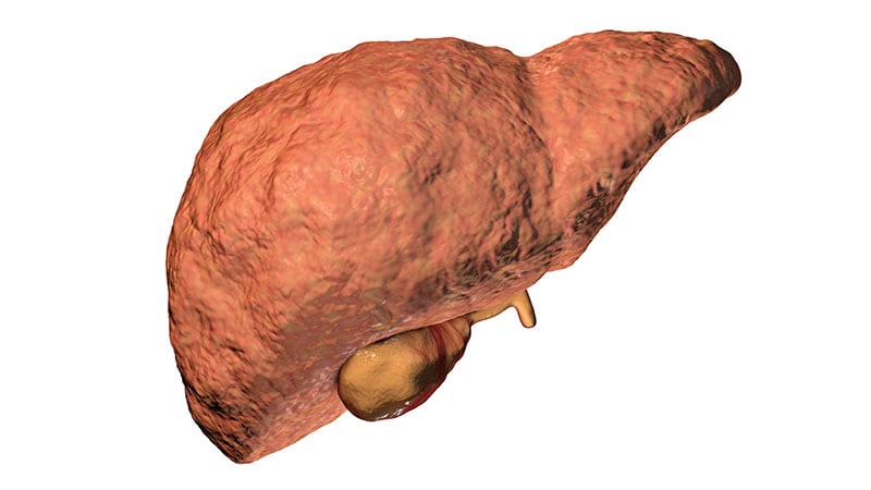 Non-invasive Liver Fibrosis Estimates Linked to Heart Failure