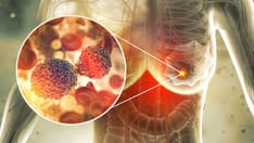 Study Compares Skin Toxicities of MEK Inhibitors in Children