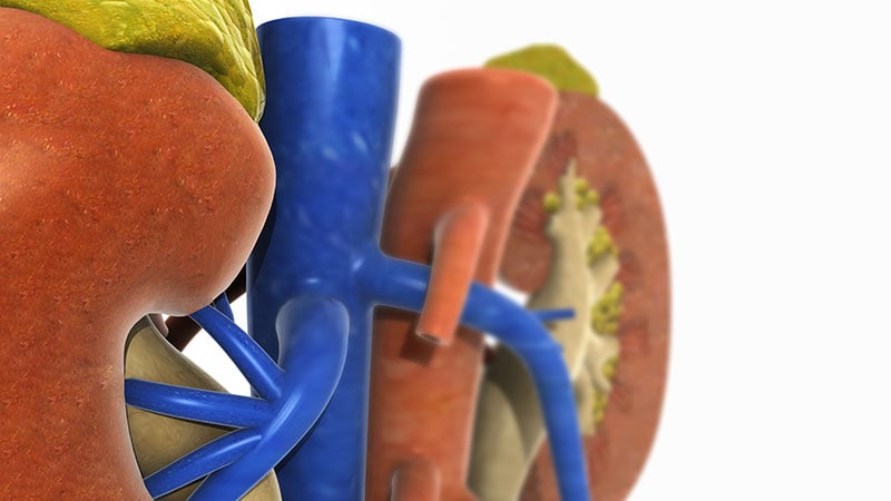 Implantable Vena Cava Sensor Successful in First Human Study