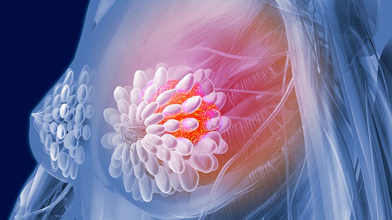 Abemaciclib Combo Improves Survival in Breast Cancer