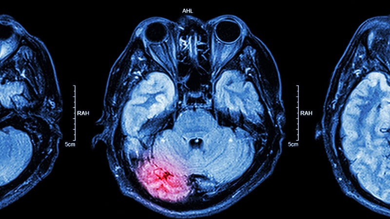 Can Glasgow Coma Scale Predict Mind Harm?