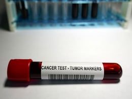 photo of Cancer Test - Tumor Markers