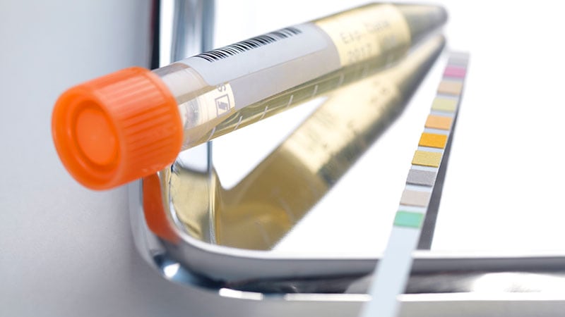 Low Follow-up of Urine Dipstick Tests in Primary Care