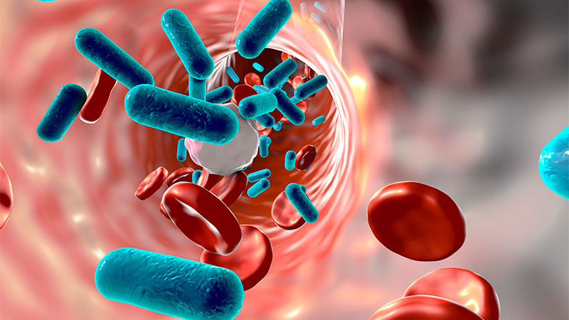 7 Days of Antibiotics as Efficient as 14 for BSI