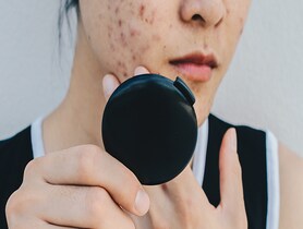 photo of shot of Acne & Problem Skin