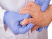 photo of senior woman with rheumatoid arthritis