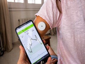 photo of Continuous Glucose Monitoring