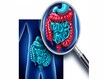 photo of Colon And Large Bowel Pain