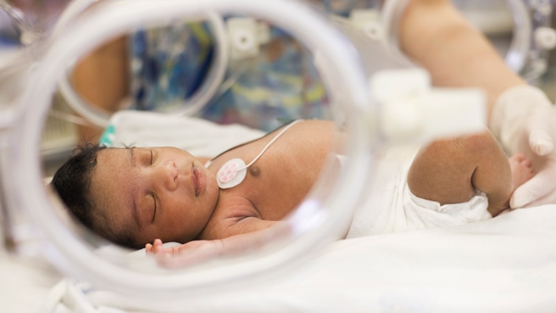Global Variation in Norepinephrine Use for Paediatric Shock