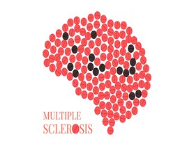 photo of Multiple sclerosis, conceptual illustrati