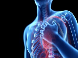 photo of Chest Pain Illustration