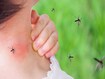 photo of mosquito bite on kid