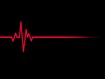 photo of heart rates