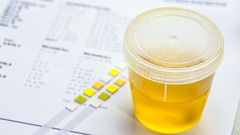 Urine Test Identifies Endocrine Hypertension With Help From AI