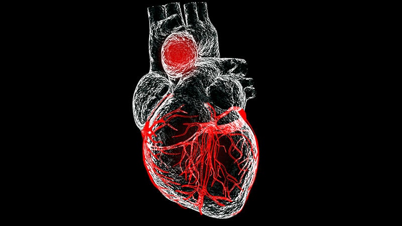 Anévrismes de l’aorte thoracique ascendante : une « lueur d’espoir » ?