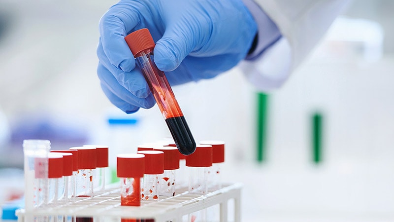 Les tests de biomarqueurs optimisent le choix thérapeutique dans le CPNPC avancé
