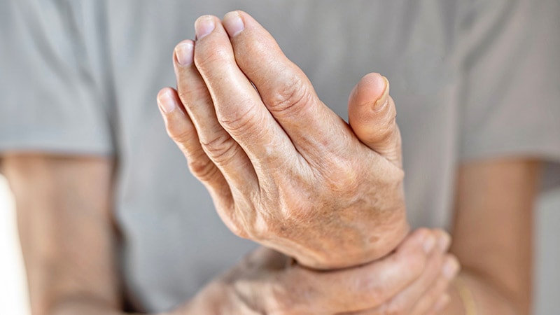 Four Clinical Variables Predict RA Development in Arthralgia