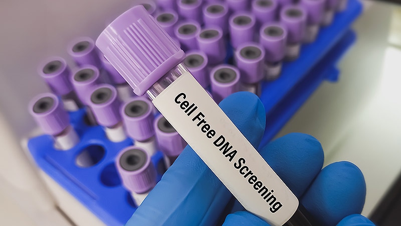 Cell-Free DNA May Inform IBD Diagnosis