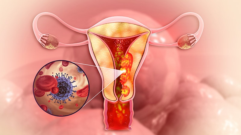 Cut the Clutter in Gynaecological Cancer Diagnosis