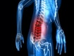 photo of back pain