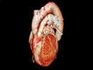 photo of a heart