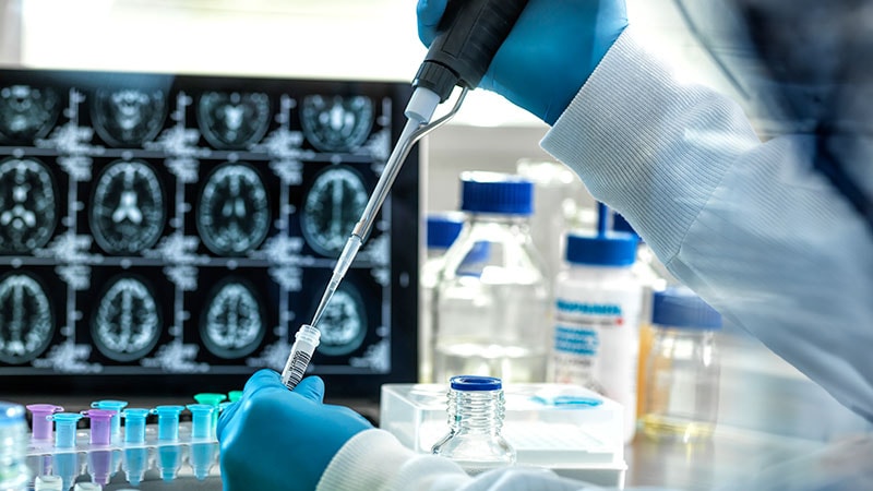 FDA's New Guidance for Early Alzheimer's Drug Development