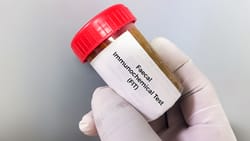 CRC: Next-Generation mt-sDNA Test Beats FIT for Sensitivity