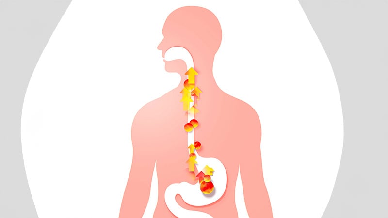 how-does-diet-affect-gastroesophageal-reflux-disease-how-does-diet