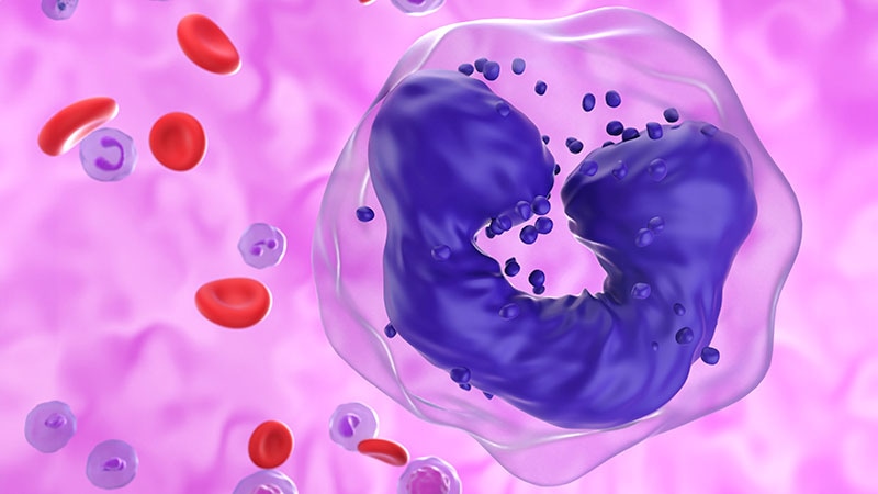 Chronic Myelogenous Leukemia (CML): 5 Things to Know