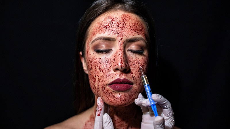 New HIV infections occur after vampire facial at unlicensed spa