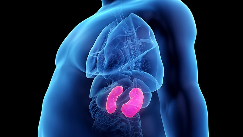 Sleeve Gastrectomy Improves Kidney Transplant Rates