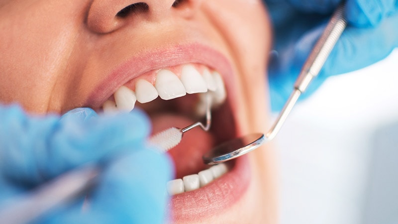 Antiplatelet Therapy and Bleeding After Dental Extraction