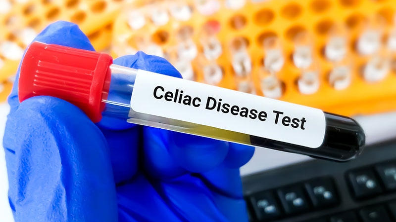 Should We All Copy Italy & Screen Kids for Celiac Disease?
