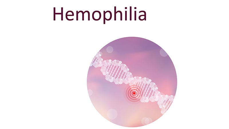 EMA Authorizes Hemophilia B Gene Therapy