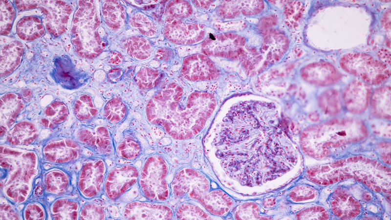 Full Response Linked to Survival in Pancreatic Most cancers