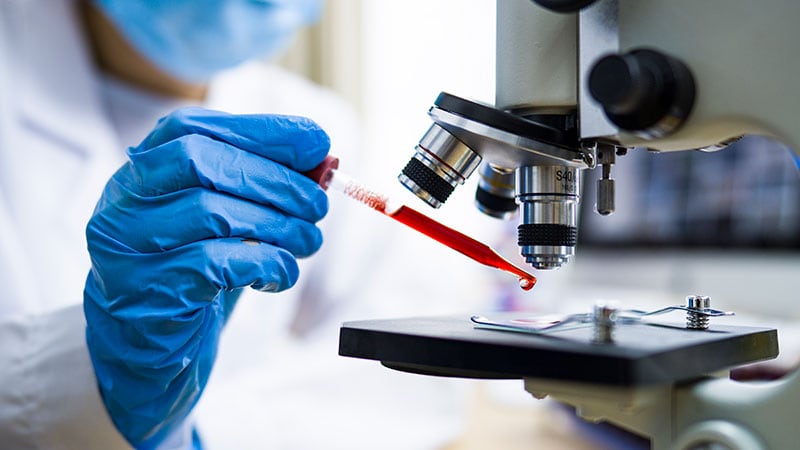 First Guideline on AD Blood-Based Biomarker Tests Released